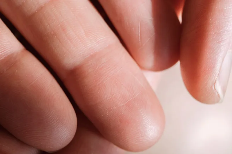 The Body as Password: Why Biometric Authentication Carries Risks That Stolen Credentials Never Could